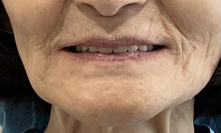 新福島中之島かとう歯科入れ歯