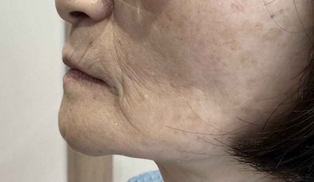 新福島中之島かとう歯科入れ歯